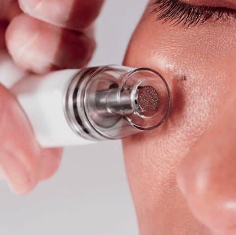 SilkPeel Dermal Infusion at Elements Med Lounge